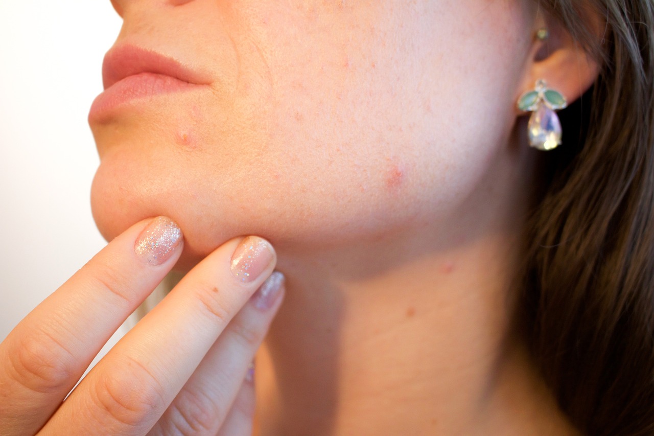 acne g980a2f7ea 1280